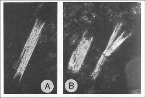 Fig. 3-3. Plagioclasa “cola de golondrina”, en traquitas (longitud tablillas 0,22 mm).
